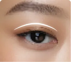 Eye Surgery