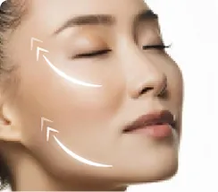 Facelift Surgery
