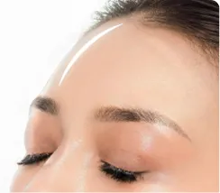 Forehead Augmentation Surgery