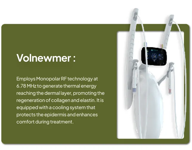 Volnewmer
