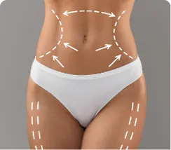 LIPosuction
